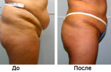Для тела